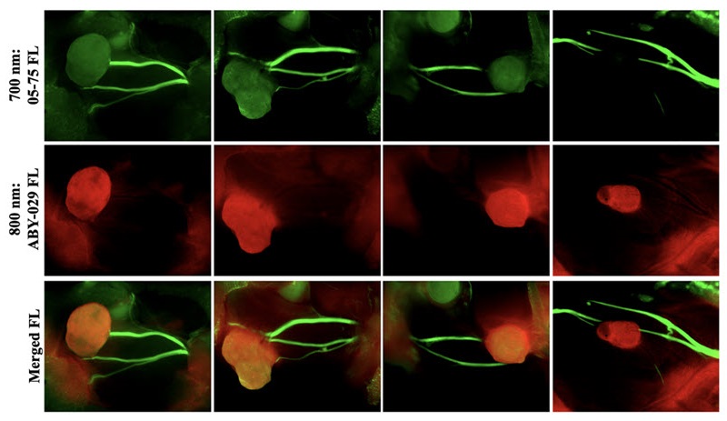 Image: Two-color fluorescence nerve and tumor visualization (Photo courtesy of D. A. Szafran et al., doi: 10.1117/1.JBO.30.S1.S13707)